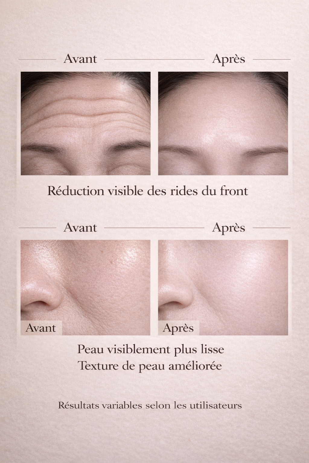 Crème anti rides rétinol avant après réduction des rides visage Originel Beauté